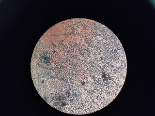 Microscopic observation of microbial culture results