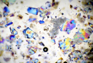 Honig im Polarisationsmikroskop