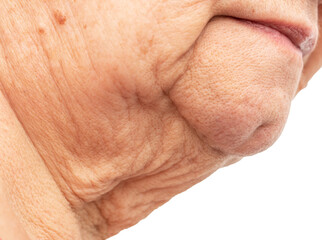 aged skin in the chin area as a background