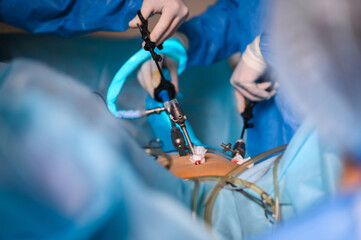 Endoscopic surgery to remove the uterus