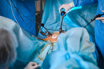 Endoscopic surgery to remove the uterus