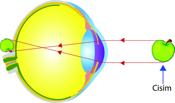 Vector Illustration of an Eye Anatomy Hypermetrope, Longsighted, Farsighted
