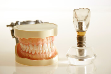 Denture and implant prosthesis, dental image 