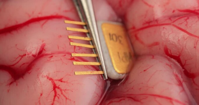 Close up of medical nurse or doctor hand in safety gloves installs a computer chip into the brain of a living being. Global Chipization. Human 2.0. Modern treatment of brain diseases.
