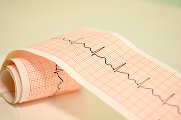 ekg line papee