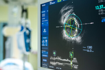 Intravascular ultrasound imaging (IVUS) at cardiac catheterization laboratory room.