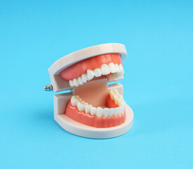 plastic model of a human jaw with white teeth on a blue background