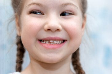 Close-up portrait of a smiling girly girl. A little girl 6-7 years old has a loose milk tooth. She...