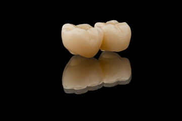 Dental bridge of 2 molar teeth. Close-up photo of metal free ceramic teeth crown isolated on black glass background. Tooth recovery with implant. Dentistry conceptual photo. Prosthetic dentistry.