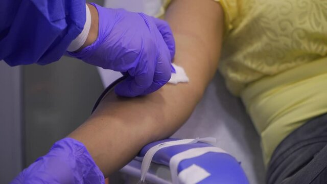 Front close-up, still shot of a woman arm while a nurse in blue gloves removes the medical tape and catheter at the end of the blood donation process.