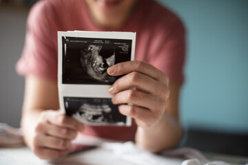 Pregnant woman holding a sonogram of her unborn baby.