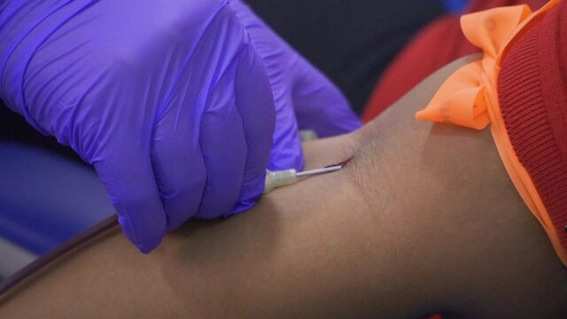 Side close-up, static shot (Slow Motion) of woman arm with a tourniquet on her arm at the moment a nurse with blue gloves introduces the catheter (syringe, needle) to donate blood.