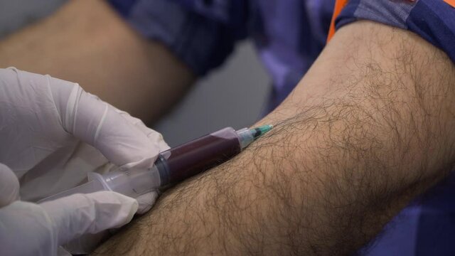 Side close-up, static shot of man arm with a tourniquet while drawing blood with a syringe (needle) a nurse with white gloves.
