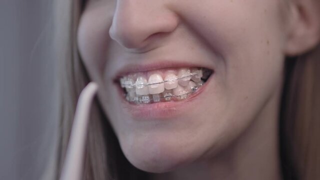 Woman cleans braces with water flosser dental irrigator. Girl takes care of braces system on her teeth. Cleans teeth with portable water flosser electric dental teeth oral Irrigator tooth cleaner.