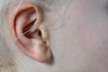 Fototapeta premium woman's ear close-up. healthcare and deafness concept