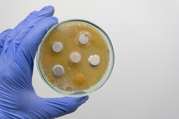 The scientist holds with his hand in a blue glove a Petri dish with columns on the antagonism of bacteria. Microbiological experiment with bacteria in a Petri dish.
