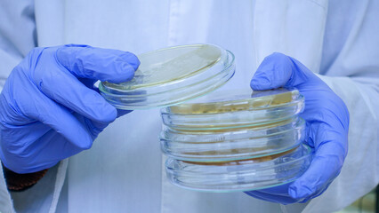 A scientist takes one top petri dish from a stack and shows it, the close-up of a stack of petri...