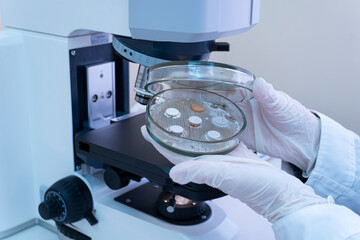 The scientist opened a Petri dish with bacteria colonies with his hand. The bacteria grew on agar posts. Cultivation of bacteria on agar.