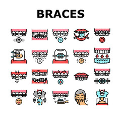 Tooth Braces Accessory Collection Icons Set Vector. Tooth Braces Installation And Correction, Metal And Sapphire, Ceramic And Plastic Material Concept Linear Pictograms. Contour Color Illustrations