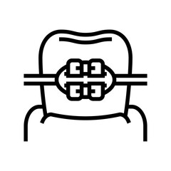 mount tooth braces line icon vector. mount tooth braces sign. isolated contour symbol black illustration