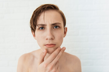 Teenage boy with the first moustache and skin problems on white background