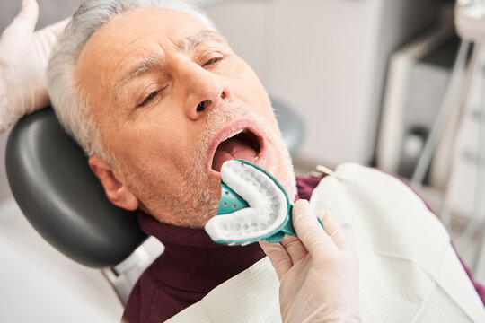 Dentist putting dental impression to patient mouth