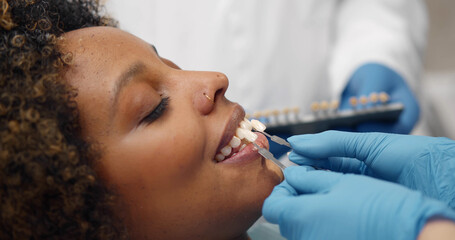 Professional dentist picking perfect shade of white veneers for female patient