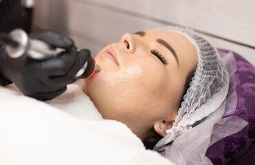 Hardware cosmetology. Closeup picture of happy young woman getting rf lifting procedure in a beauty parlour. Radio lifting.