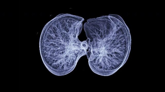 CT Chest or Lung 3D rendering image axial view for diagnosis TB,tuberculosis and covid-19 .