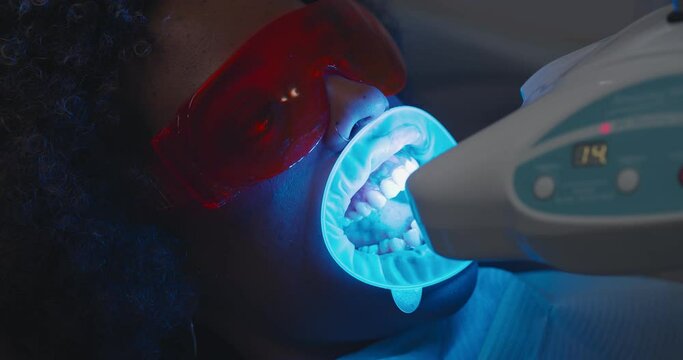 Close up of woman patient having teeth whitening procedure with ultraviolet light uv lamp.