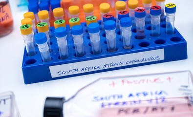 Several vials positive for covid-19 infection of the new variant in the south africa, conceptual...