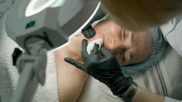 Professional cleansing of acne in a beauty salon. Facial skin care.