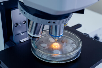 Study of bacterial colonies under a microscope. Close-up of a Petri dish with bacterial colonies on agar column under a microscope magnification.