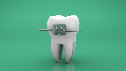 Teeth braces. Green background. 3d render