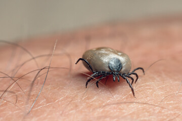 A tick drunk on blood crawls on human skin
