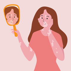 The woman with vetiligo looks at her face in the mirror.