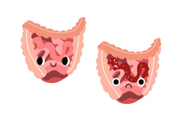 Cute intestines characters with smiling and sad face. Funny kawaii human internal organ with eyes. Healthy and illness gut, colon disease. Gastroenterology. Vector flat cartoon illustration