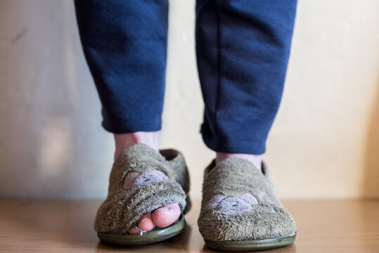 Una mujer joven usando dos pantuflas de casa muy gastadas, rotas y muy usadas enseñando los dedos de sus pies por la parte de delante. Zapatillas de andar por casa de mujer o niña con agujeros. 