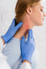 Doctor inspecting neck of woman with allergy redness