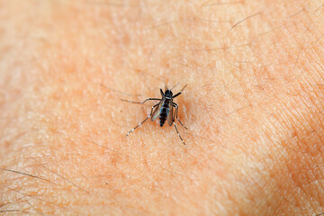 A mosquito sucks blood on human skin