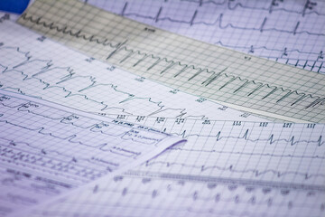 Electrocardiogram strips with cardiac arrhythmias. Acute myocardial infarction. Selective focus on some beats. Free space to write.