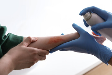 Applying burn spray onto injured skin, closeup