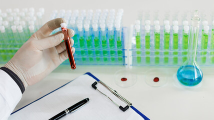 Immunological laboratory studies. A test tube with a blood sample in the hands of a doctor.