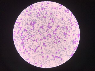 Immature and mature white blood cells.Segmented neutrophil,blast cells myelocyte,metamyelocyte,Band...