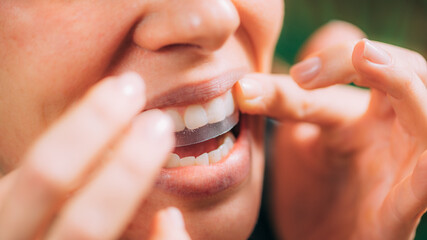 Woman Using Whitening Stipes or Whitestrips. Whitening Teeth at Home.