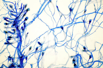 Microscope of black fungus spore strain with Lactophenol cotton blue, molds or yeasts with macro...