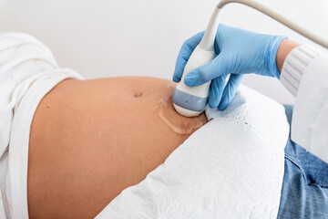 Gynecologist doctor wearing protection face mask does ultrasound, sonogram procedure to a pregnant woman. Pandemic time and health care concept.