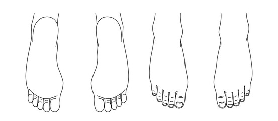 カルテ 人体図 足 イラスト