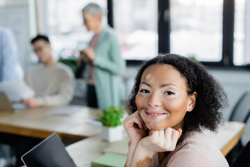 Smiling african american businesswoman with vitiligo looking at camera