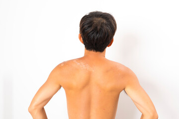 Naklejka premium Asian man with sunburned skin and face on white background.